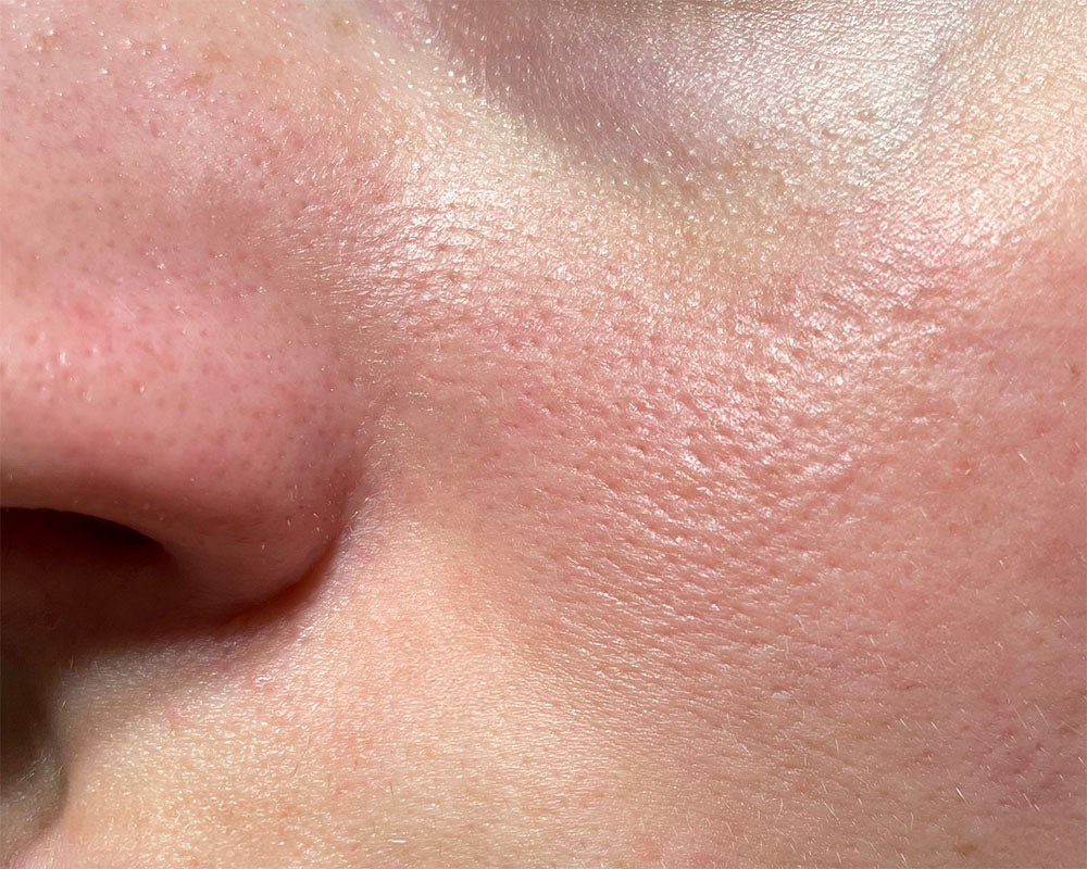 The Skin Barrier: Why it matters more than you think.